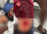 Hutang Lama Berujung Darah, Pria di Banggai Laut Alami Lima Tusukan