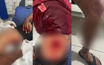 Hutang Lama Berujung Darah, Pria di Banggai Laut Alami Lima Tusukan