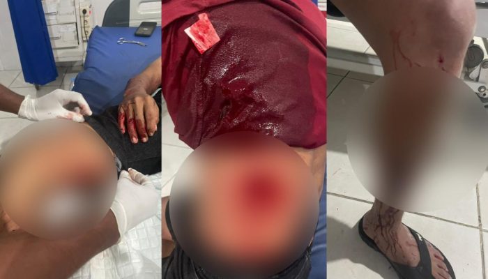 Hutang Lama Berujung Darah, Pria di Banggai Laut Alami Lima Tusukan